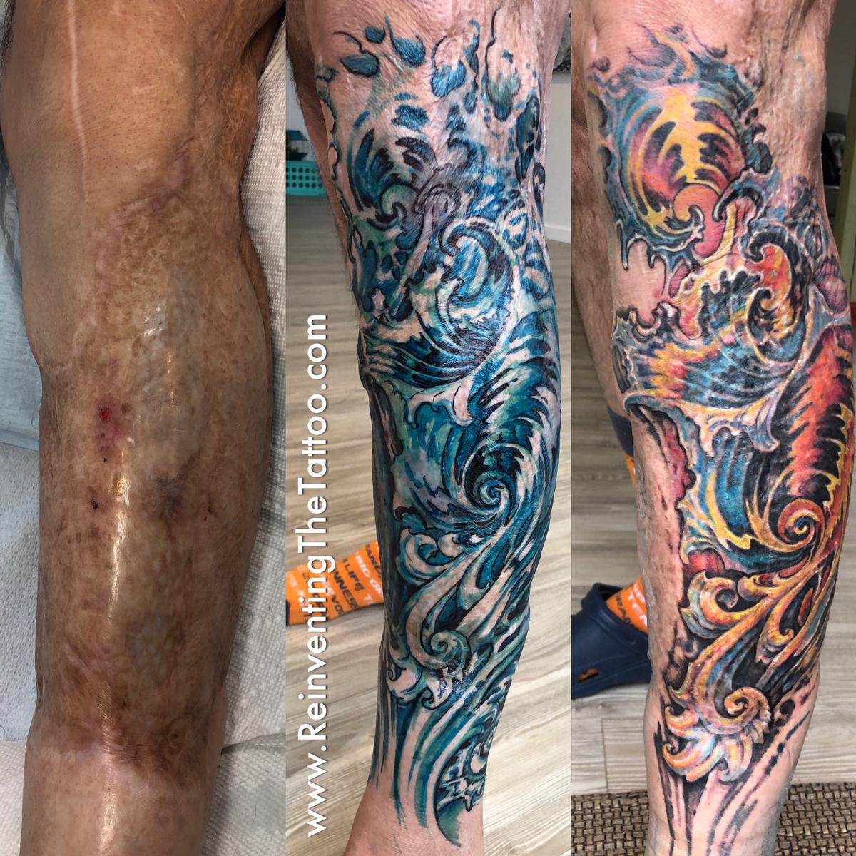 Is Scar Tissue Tattooable?